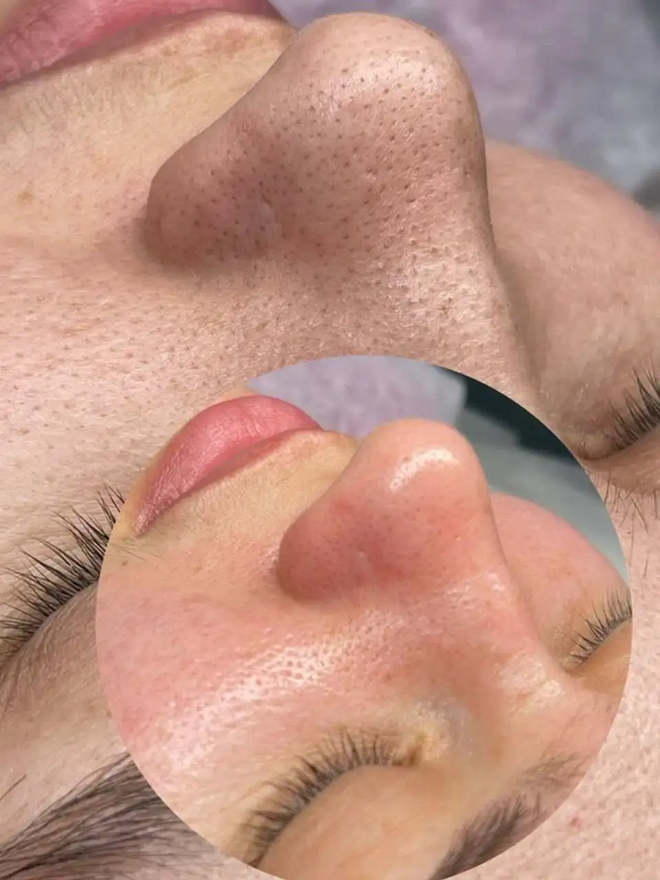 Косметологические услуги в Тюмени - Розыгрыши/Конкурсы в Тюмень