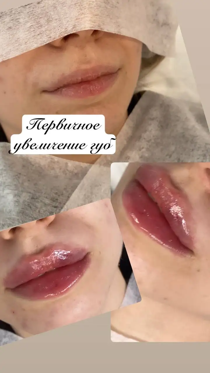 Косметологические процедуры для красоты и молодости в Тюмени - Косметология (Услуги) в Тюмень