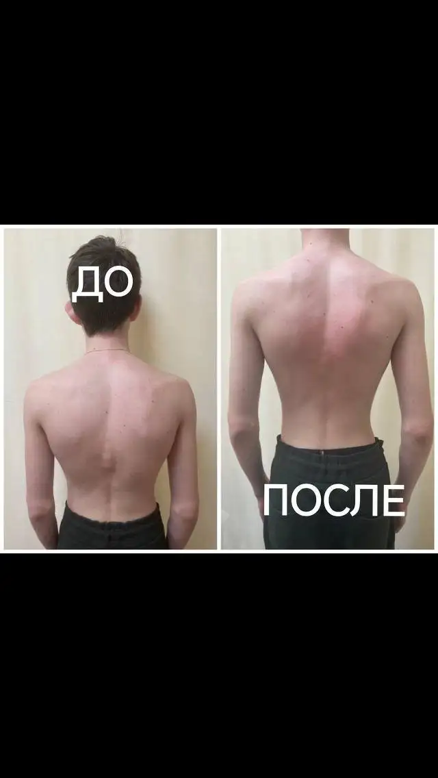 Услуги массажиста: общий, антицеллюлитный, детский и др. - Услуги в Люберцы
