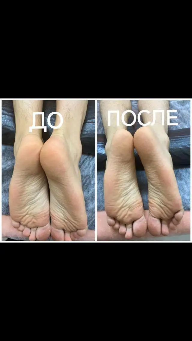 Услуги массажиста: общий, антицеллюлитный, детский и др. - Услуги в Люберцы
