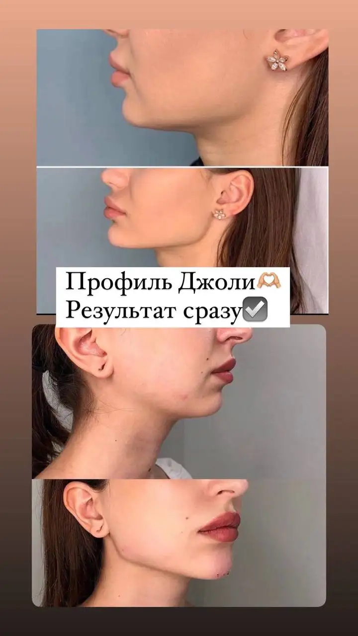 Контурная пластика и косметологические услуги - Косметология (Красота и здоровье) в Москва