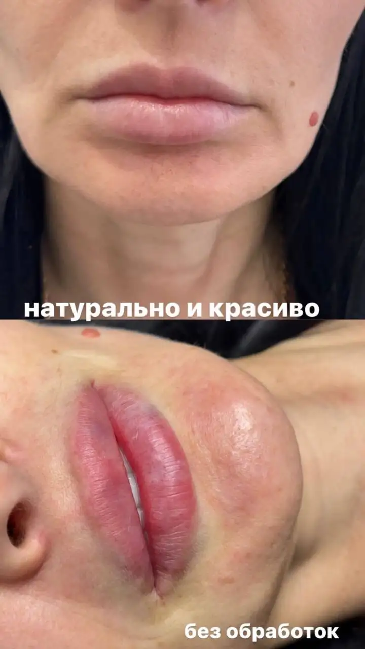 Контурная пластика и косметологические услуги - Косметология (Красота и здоровье) в Москва