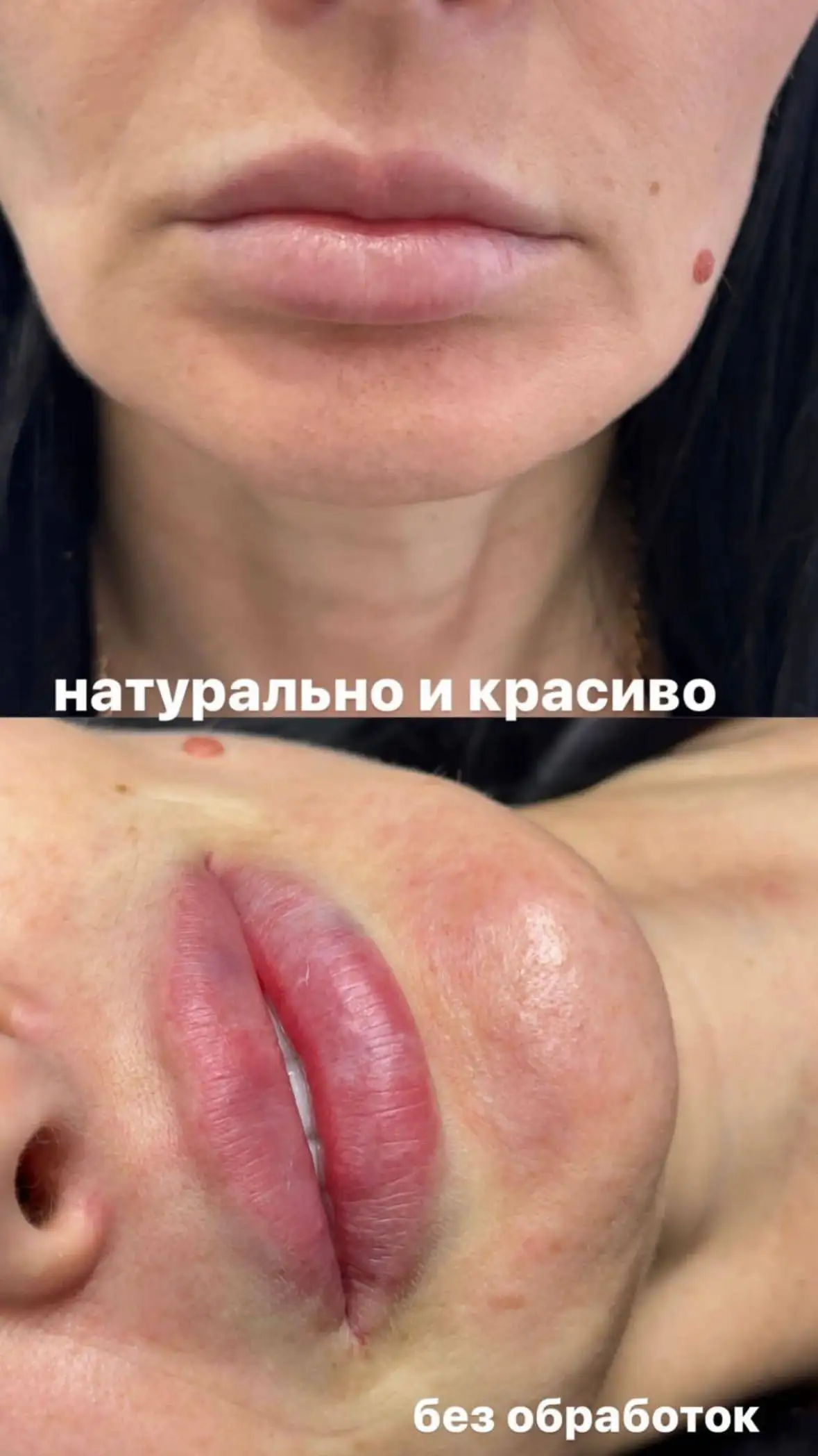 Срочно требуются модели на контурную пластику - Косметологические услуги (Услуги) в Москва