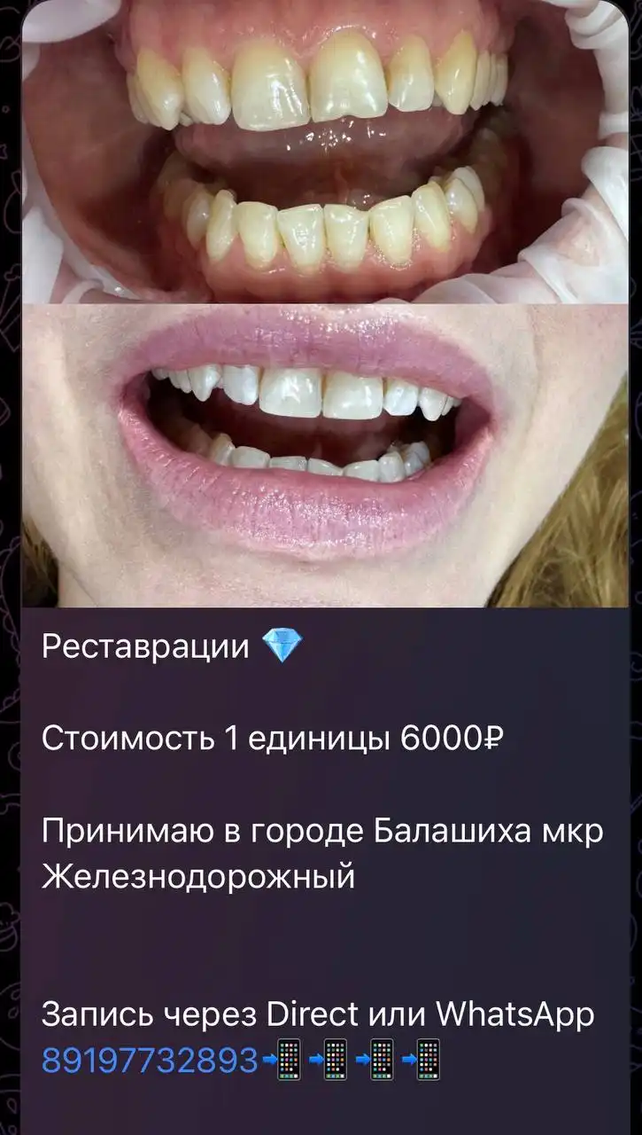 Услуги стоматолога в Балашихе - Медицинские услуги (Услуги) в Балашиха