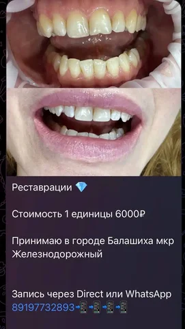 Услуги стоматолога в Балашихе - Аренда квартир в Балашиха