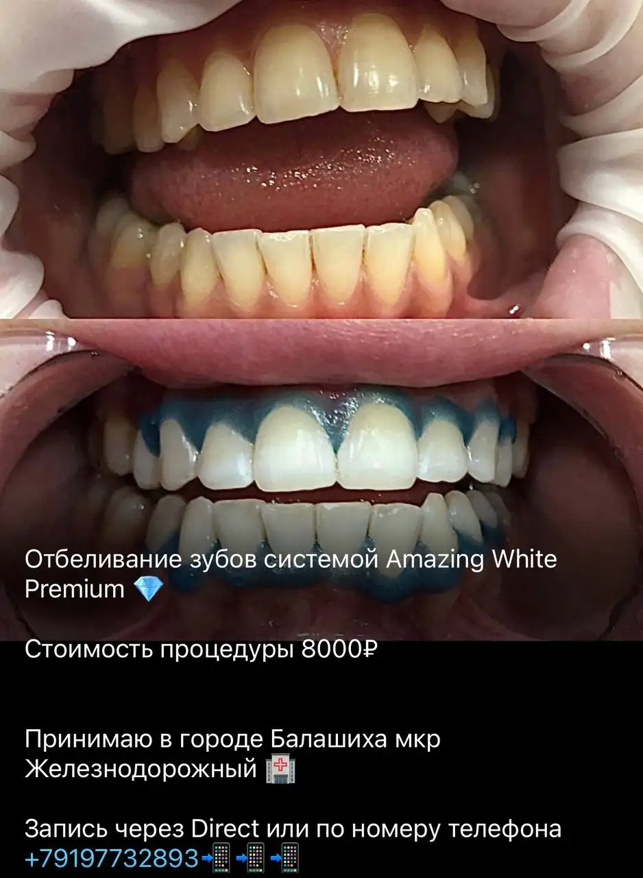 Услуги стоматолога в Балашихе - Медицинские услуги (Услуги) в Балашиха