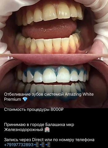 Услуги стоматолога в Балашихе - частное объявление в Балашиха