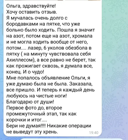 Натуральные кремы и старинный метод лечения ячменя - Фотоуслуги в Барнаул