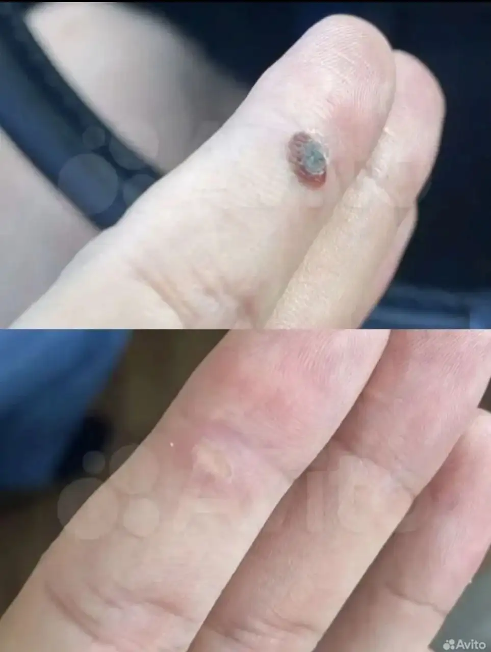 Натуральные кремы от грибка, бородавок, мозолей и папиллом - Кремы (Красота и здоровье) в Барнаул