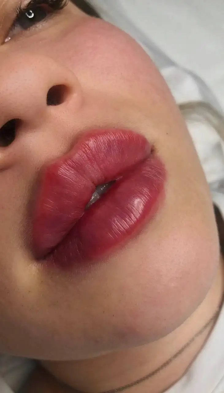 Косметологические услуги по омоложению лица - Косметология (Красота и здоровье) в Реутов