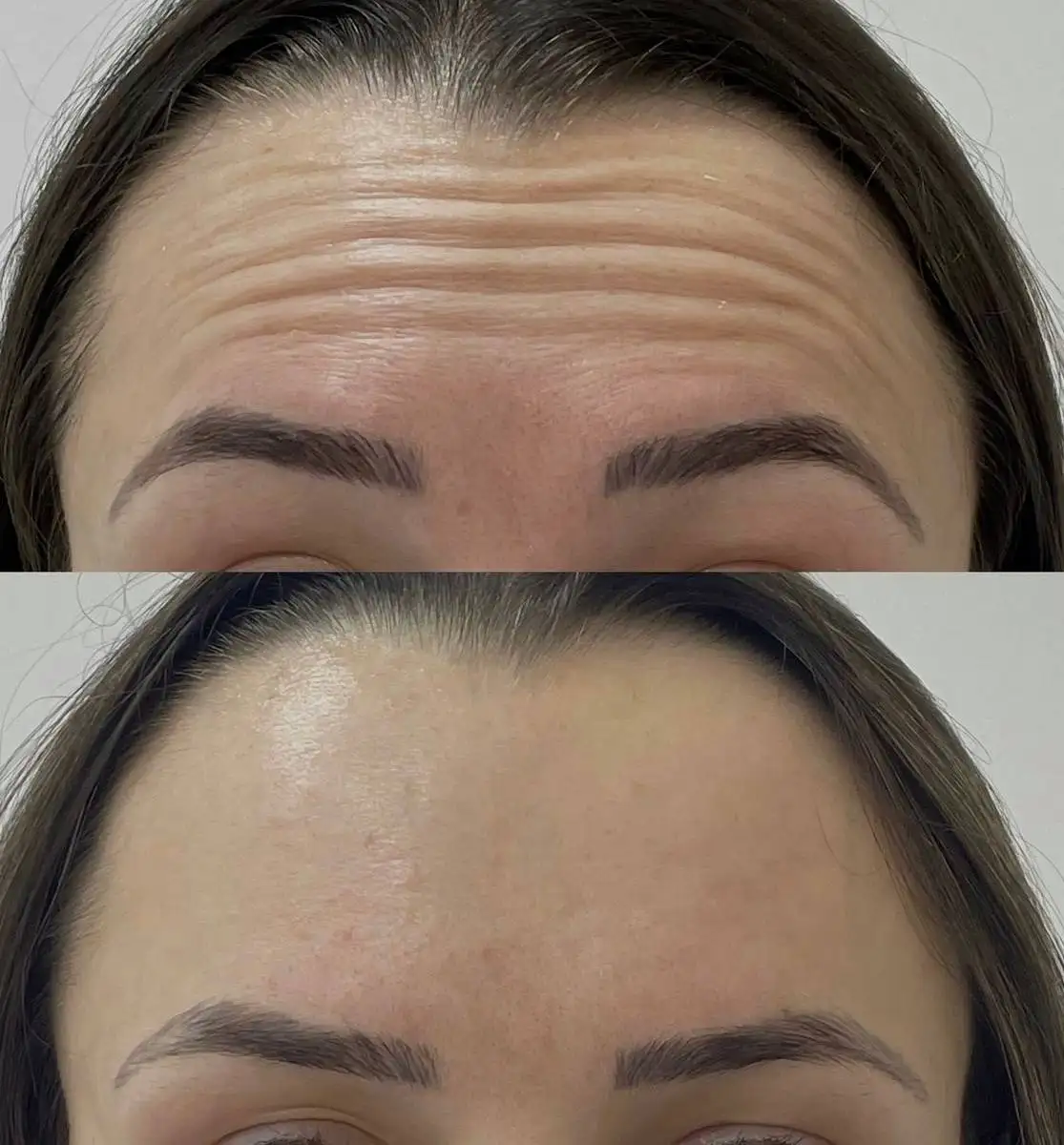 Косметологические услуги по омоложению лица - Косметология (Красота и здоровье) в Реутов