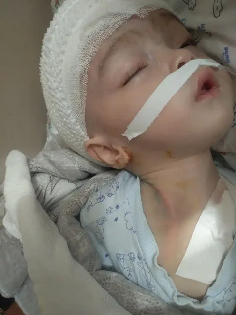 Просьба о помощи для лечения ребенка с диагнозом гидроцефалия - Работа в Самара