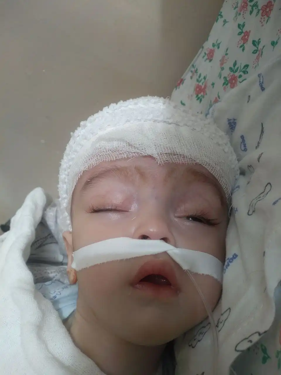 Просьба о помощи для лечения ребенка с диагнозом гидроцефалия