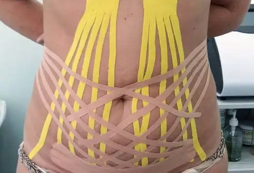 Услуги кинезиолога и тренера ЛФК с медицинским образованием - Медицинские услуги (Услуги) в Химки