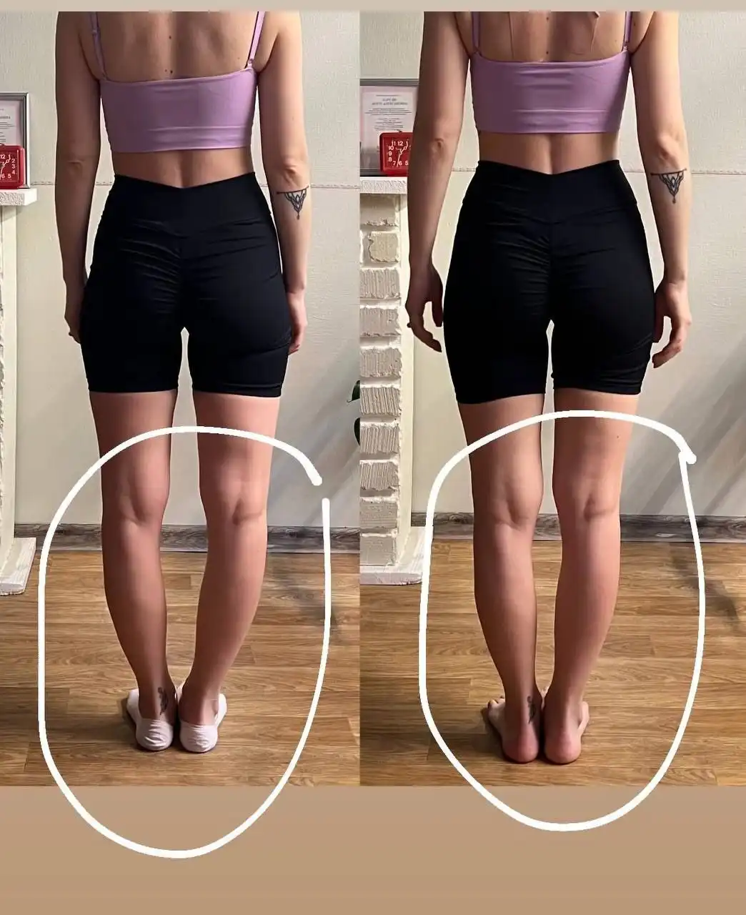 Услуги кинезиолога и тренера ЛФК с медицинским образованием - Медицинские услуги (Услуги) в Химки