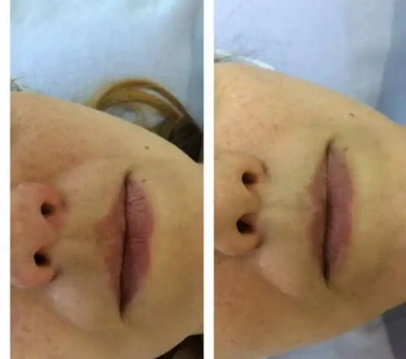 Профессиональный массаж лица с подарком - Массаж (Услуги) в Пермь