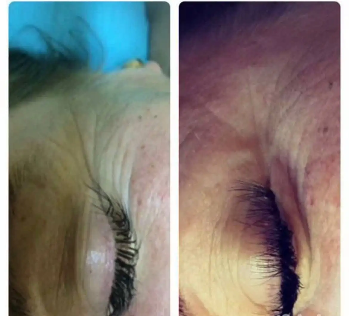 Профессиональный массаж лица с подарком - Массаж (Услуги) в Пермь