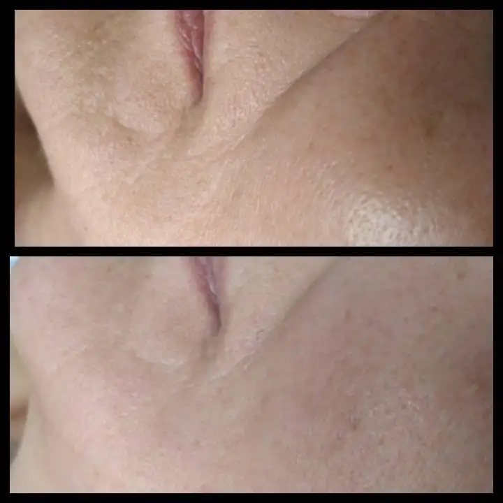 Профессиональный массаж лица с подарком - Массаж (Услуги) в Пермь