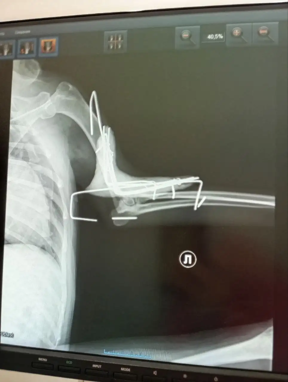 Сбор средств на лечение собаки Рыжули - Животные в Саратов