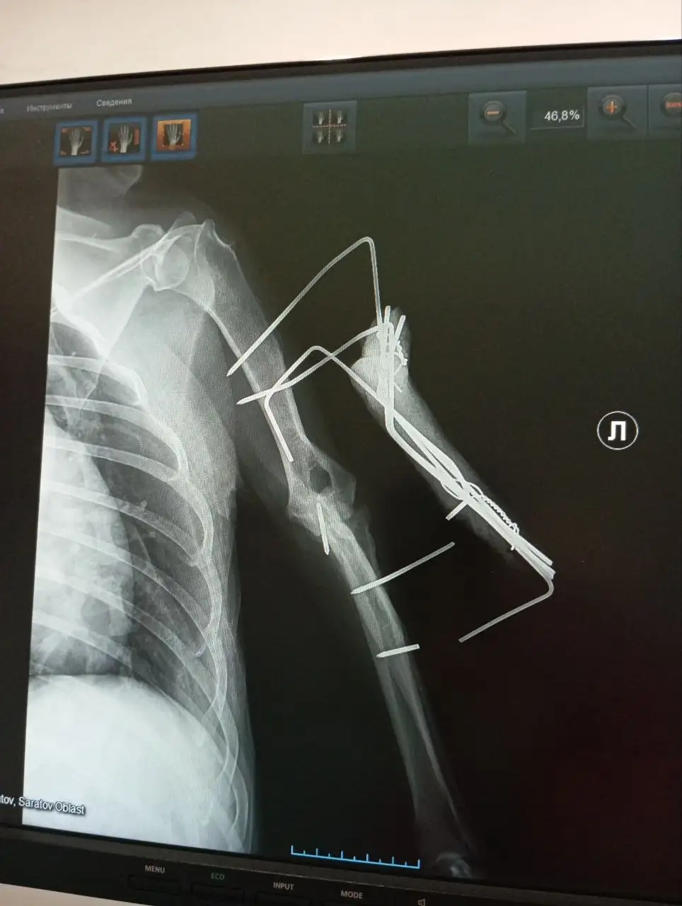 Сбор средств на лечение кошки Рыжули - Ветеринария (Животные) в Саратов